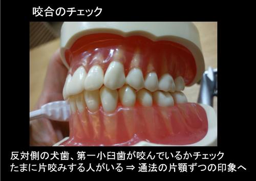 誰にでもできる咬合採得 誰にでもできる咬合採得 | 日本顎咬合学会 |本 | 通販 | Amazon
